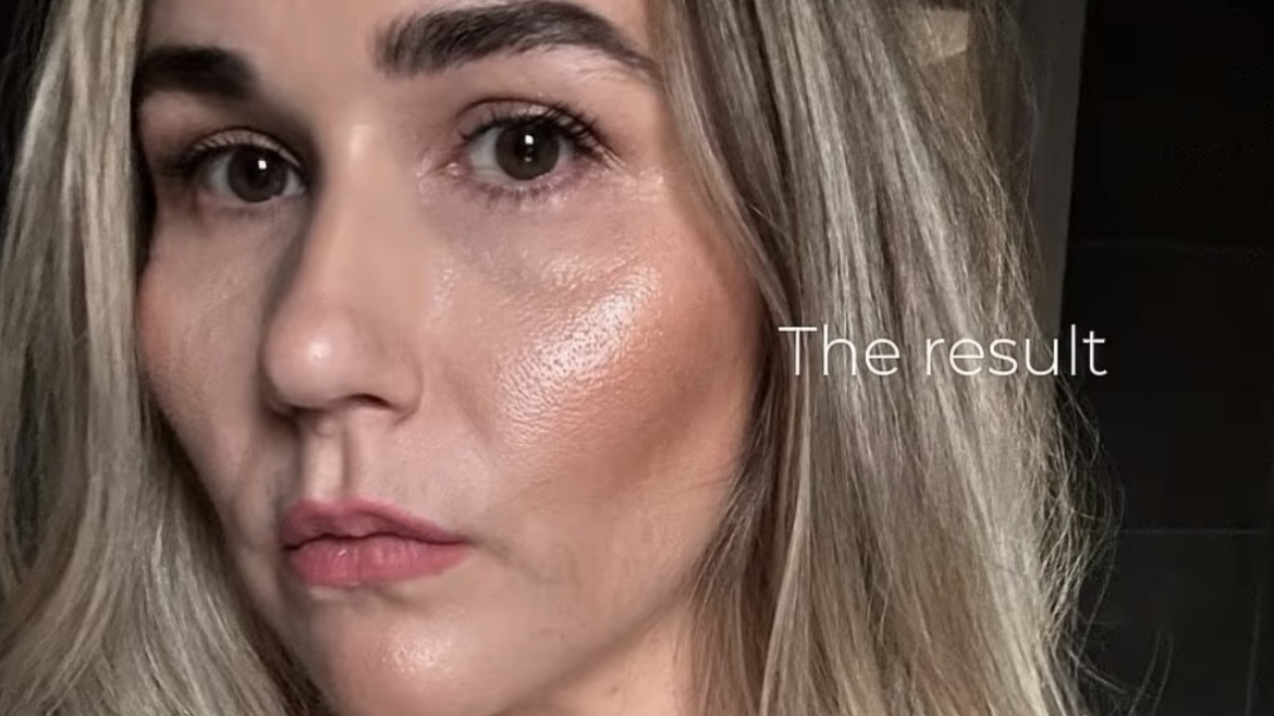 Collagen Treatments in Plymouth