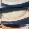 Polynucleotides & Scars in Plymouth