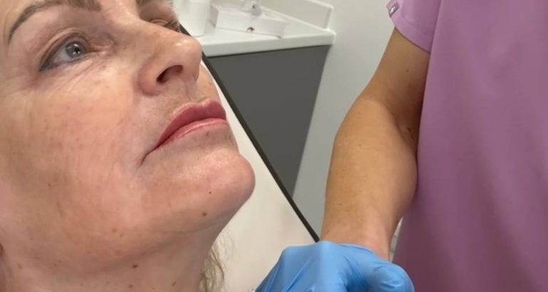 Best Autumn Skin Treatments in Plymouth: Profhilo Structura, Profhilo Body, and Morpheus8