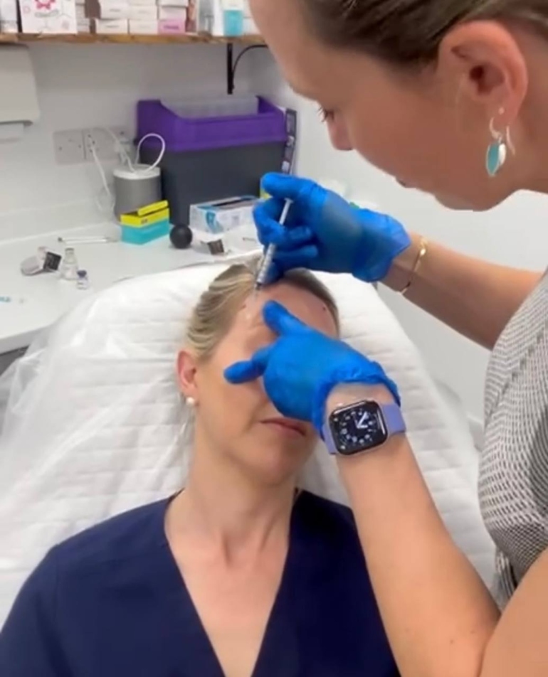 Treatment Combo to Have This Autumn in Plymouth