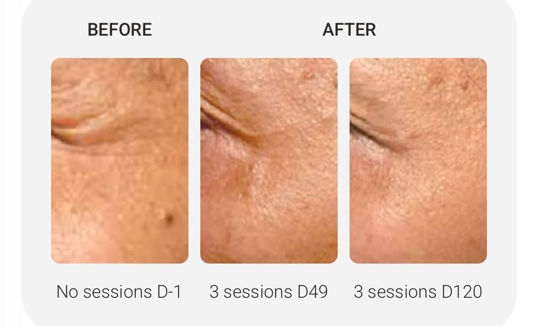 How NCTF Helps Repair Winter Skin in Plymouth