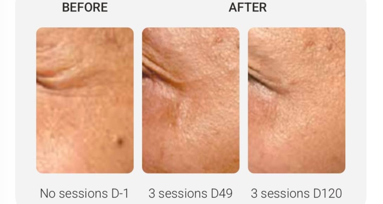 How NCTF Helps Repair Winter Skin in Plymouth