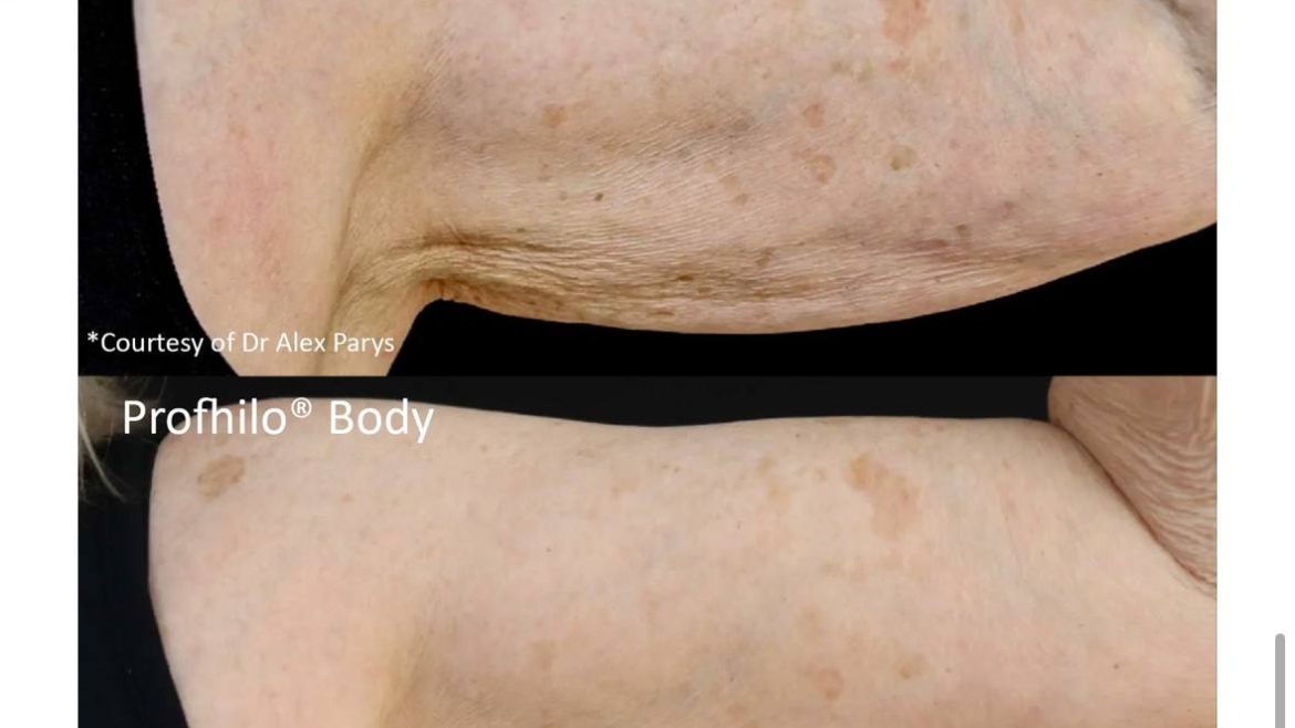 Best Treatments to Have Before Spring Starts in Plymouth