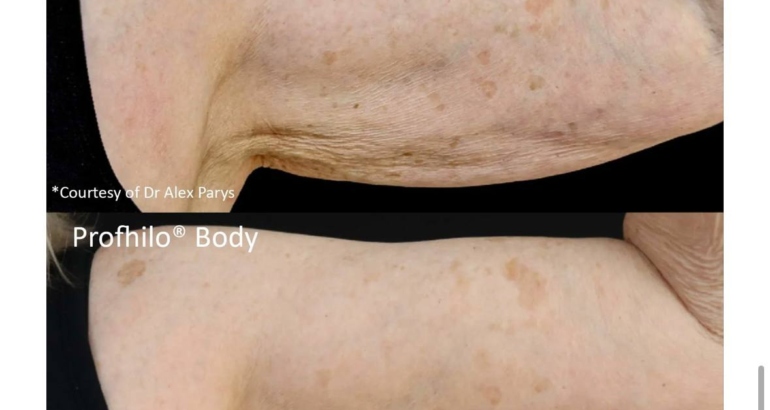 Best Treatments to Have Before Spring Starts in Plymouth